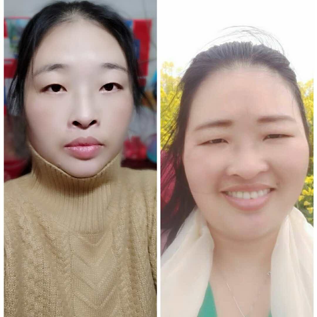 纯中药外敷减肥的头像